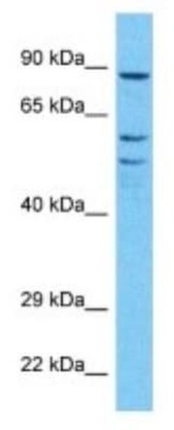RPE65 Rabbit anti-Human, Polyclonal, Novus Biologicals:Antibodies:Primary